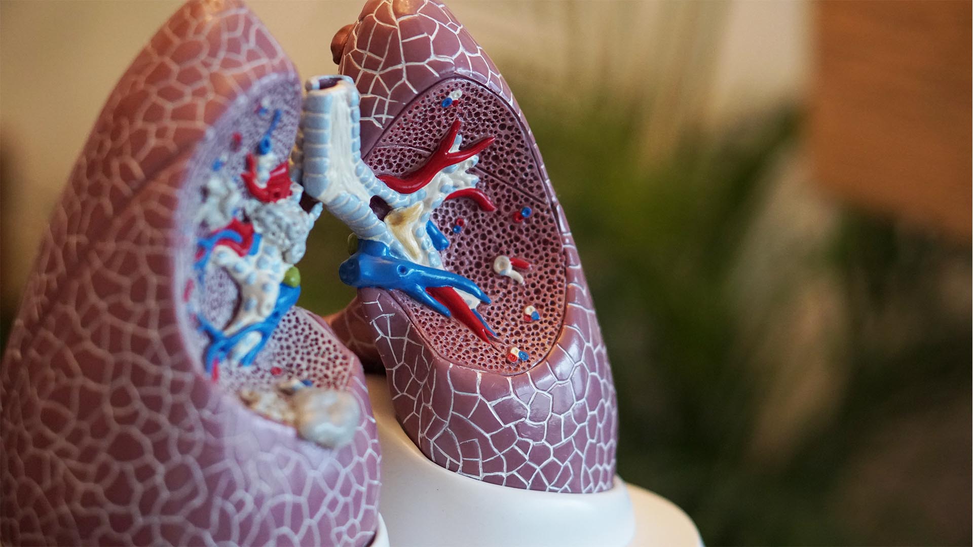 medical model of lungs