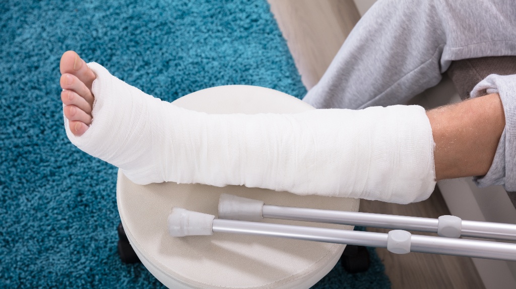 man's leg in a cast